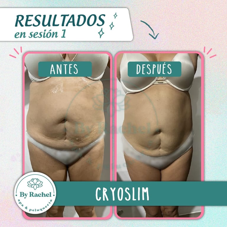 Resultado del tratamiento