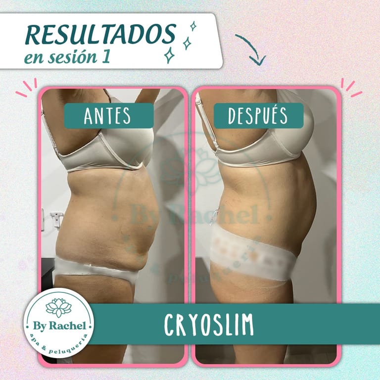 Resultado del tratamiento