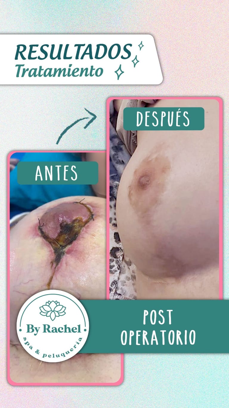 Resultado del tratamiento