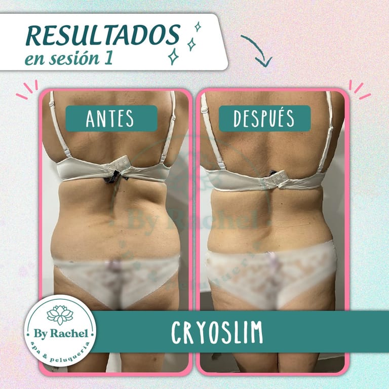 Resultado del tratamiento