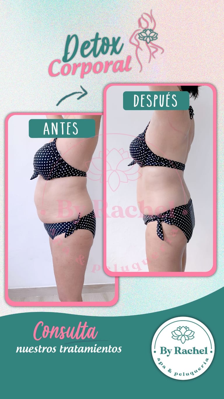 Resultado del tratamiento