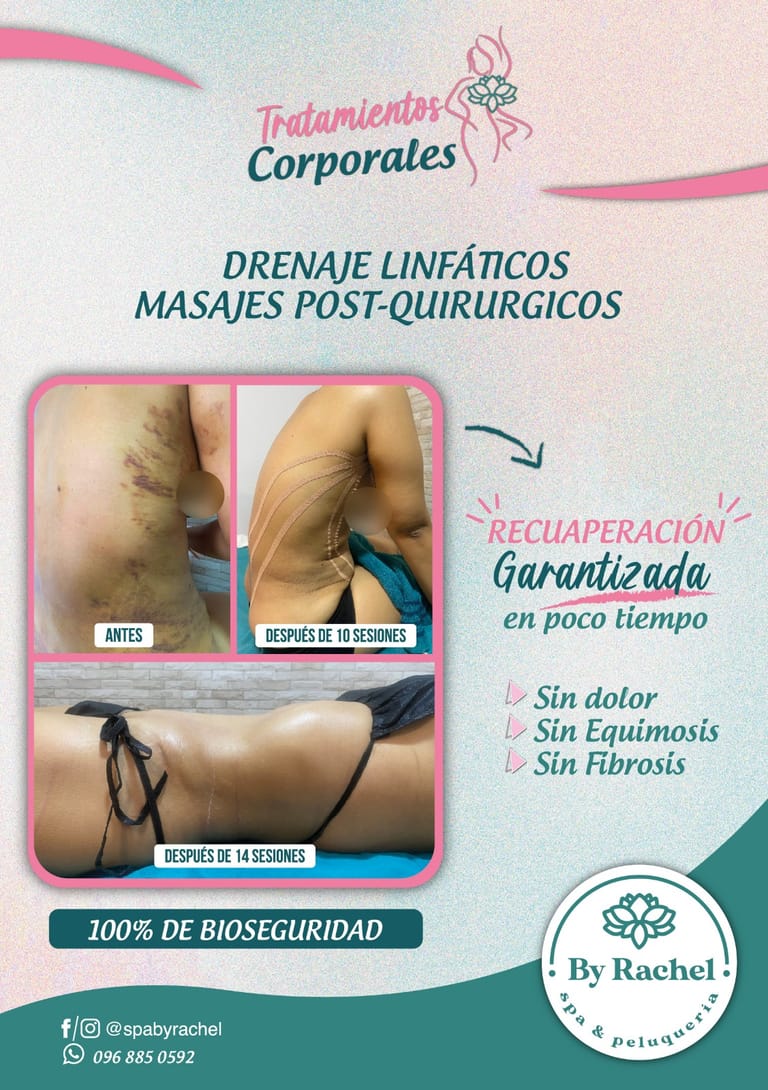 Resultado del tratamiento