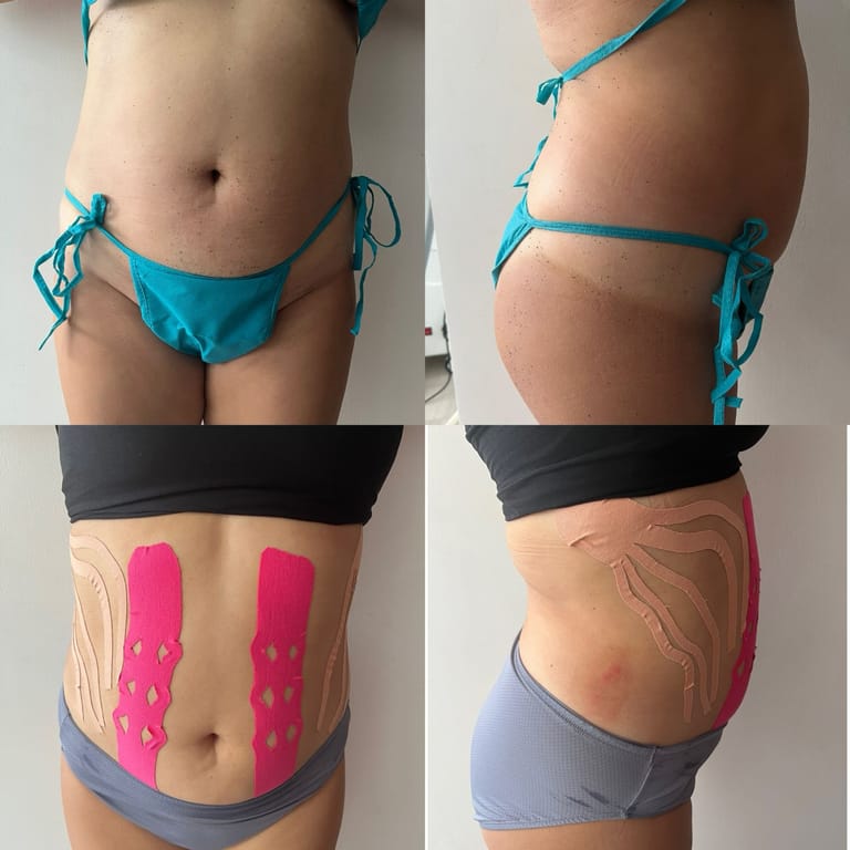 Resultado del tratamiento