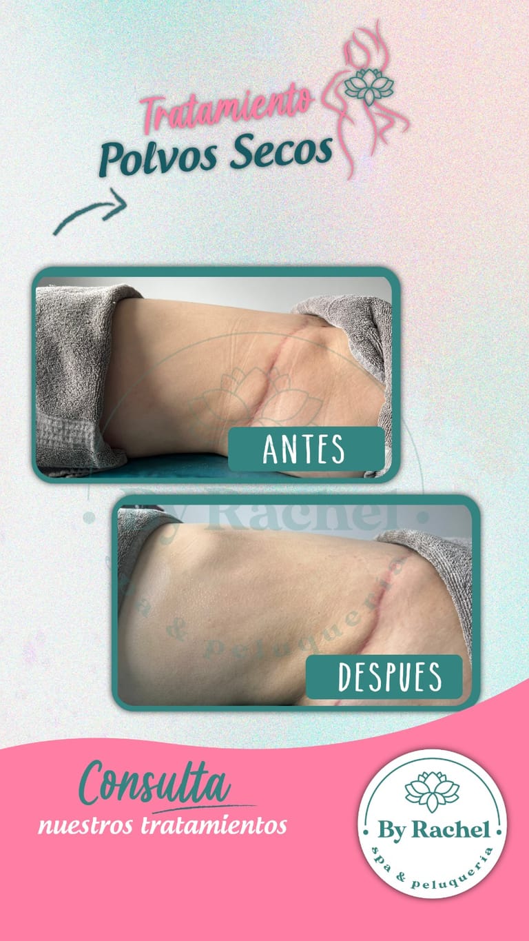 Resultado del tratamiento