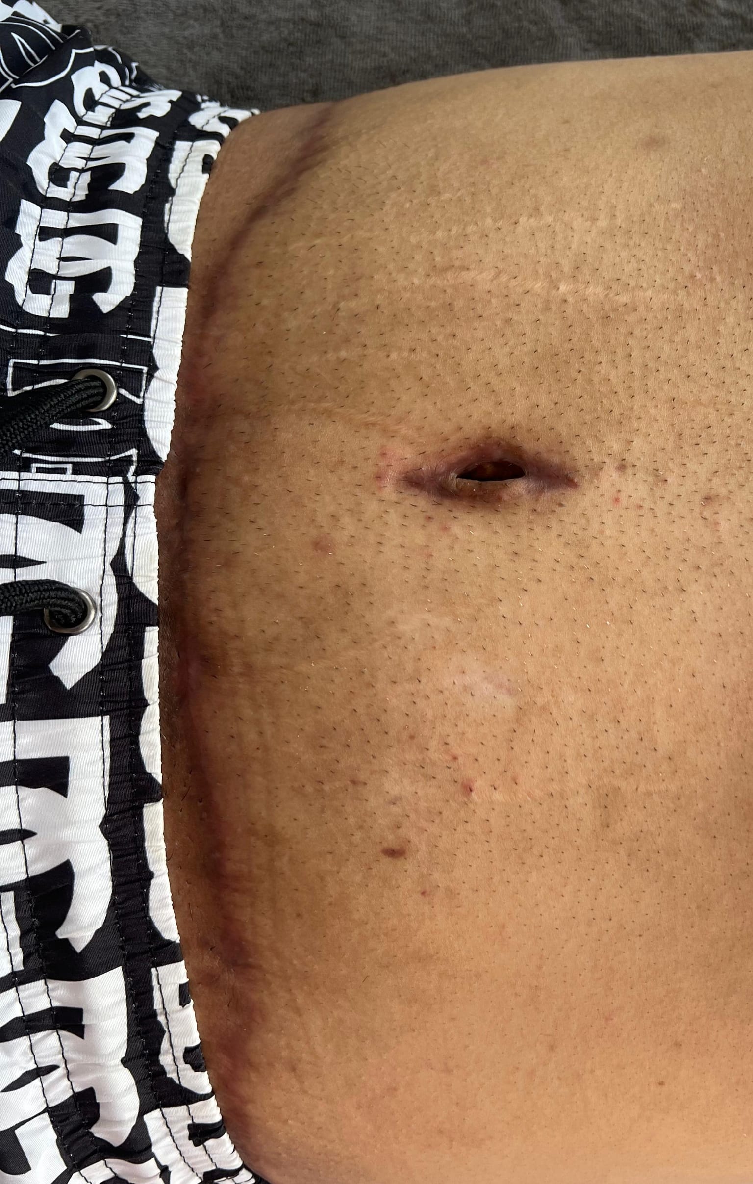 Después del tratamiento