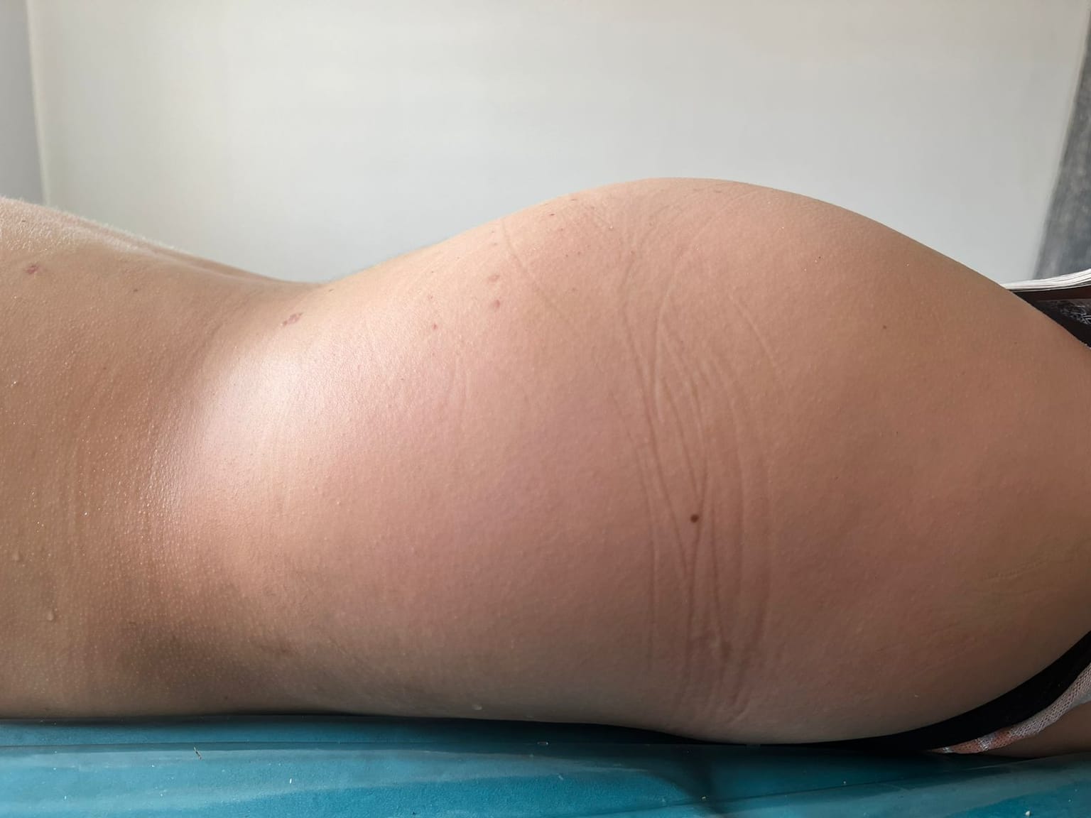 Después del tratamiento