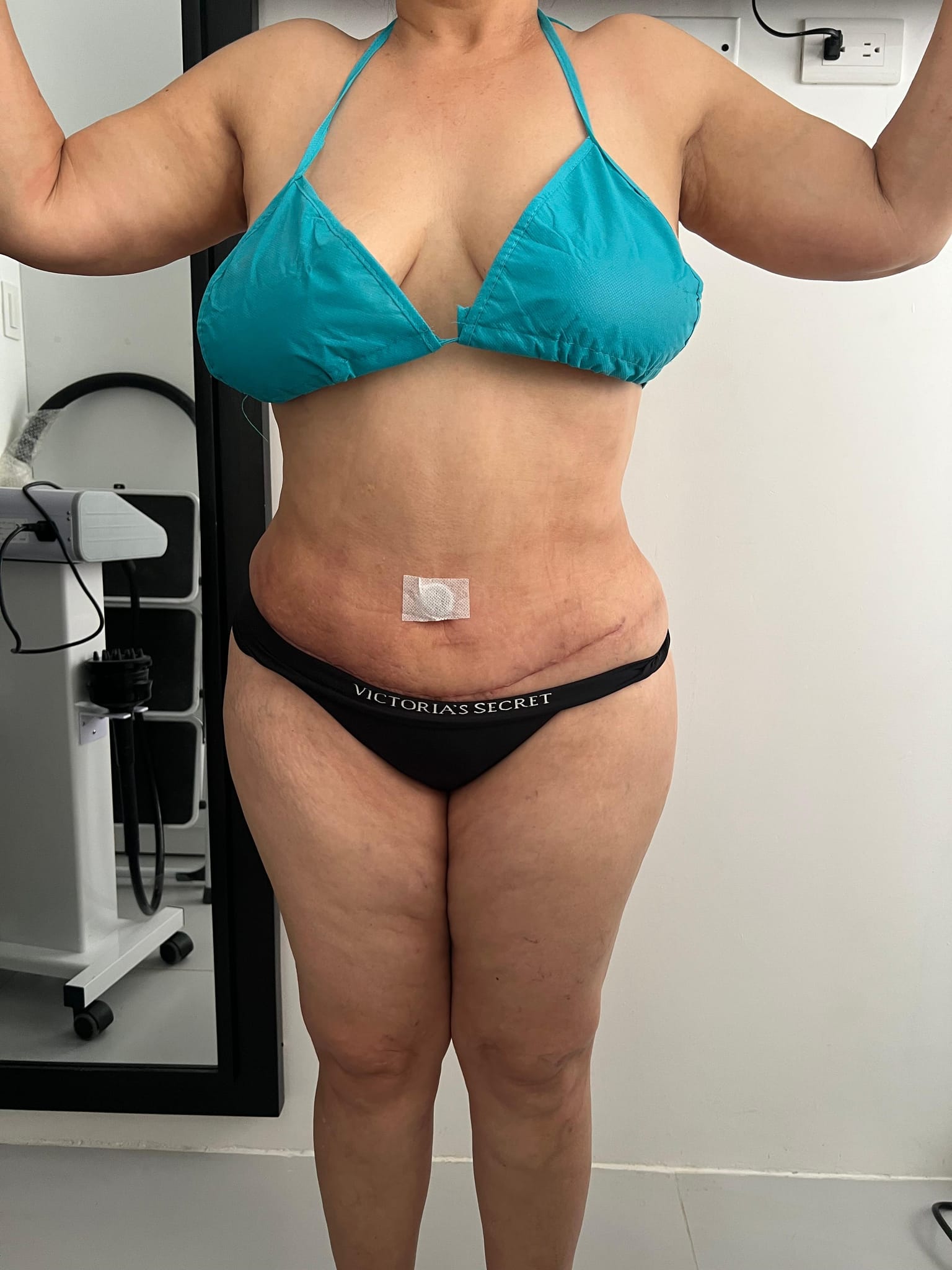 Después del tratamiento